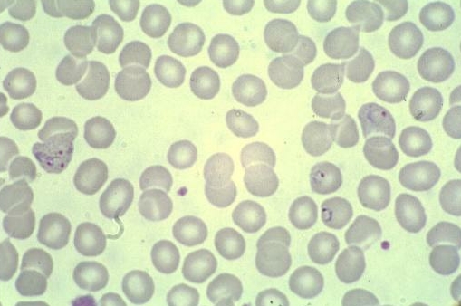 Malaria? Diagnosi in 30 minuti, lo dice il Cnr