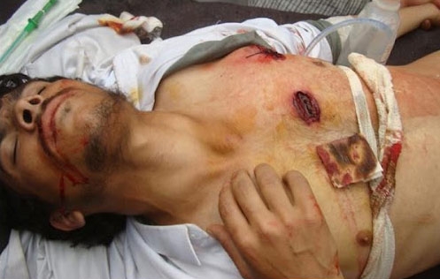 Yemen. Attacco kamikaze, almeno 40 morti