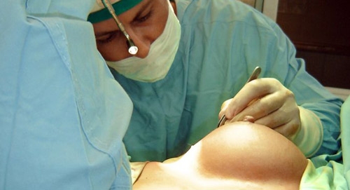 Protesi seno. Si indaga per lesioni personali contro la società produttrice e l’ente certificatore tedesco