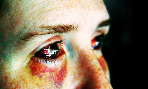 L’Italia firma la convenzione sulla lotta alla violenza domestica sulle donne