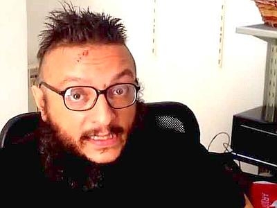 Cancro on line. Cerco una cura per il mio tumore al cervello. IL VIDEO