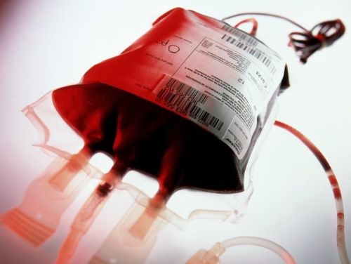Anemia falciforme. A Ferrara i bambini vengono salvati con un test da 2 euro