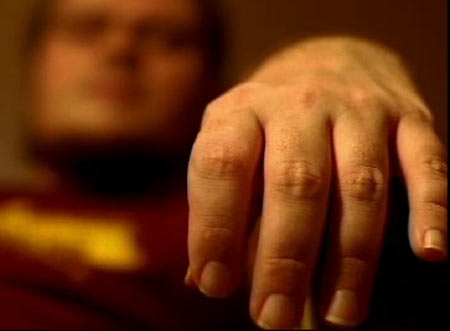 Sla, l’appello di Usala: “Se non vi basta lo sciopero della fame avrete i morti in tv”