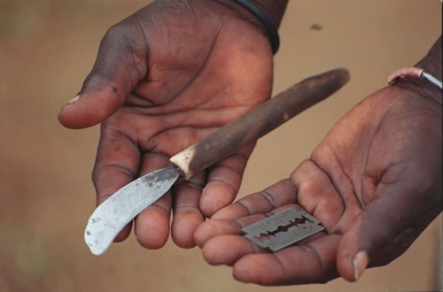 Voto Onu. Approvata risoluzione contro le mutilazioni genitali femminili