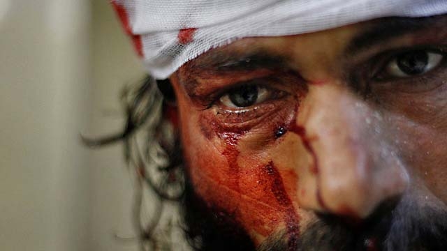 Siria. 2,5 milioni di civili colpiti dal conflitto