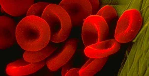 Emofilia. Contagiati sangue infetto. FedEmo chiede giustizia al Governo