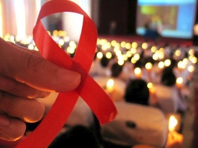 Aids, possibile bloccare il virus prima che attacchi le cellule