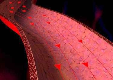 Ipertensione polmonare arteriosa, depositato il dossier registrativo di riociguat
