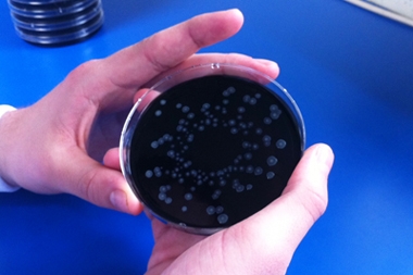 Sanità. Legionella, rischio infezioni è problema emergente
