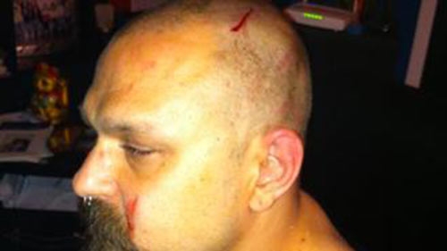 Il gruppo dei 99posse aggredito a Velletri dai neofascisti