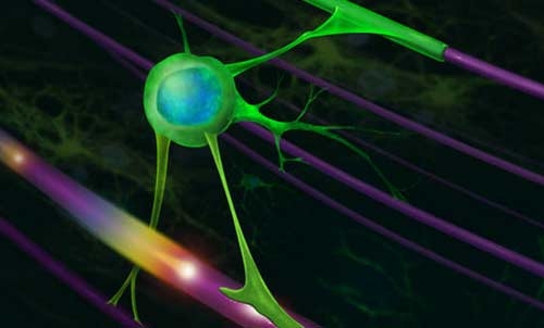 Sclerosi Multipla,  nuova tecnica di risonanza magnetica fornisce diagnosi più precise