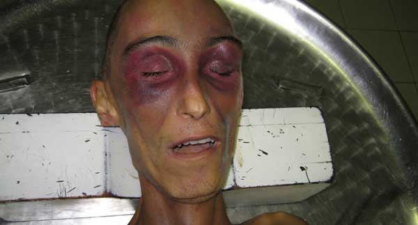 Le foto di Stefano Cucchi non possono essere cancellate da una sentenza giudiziaria
