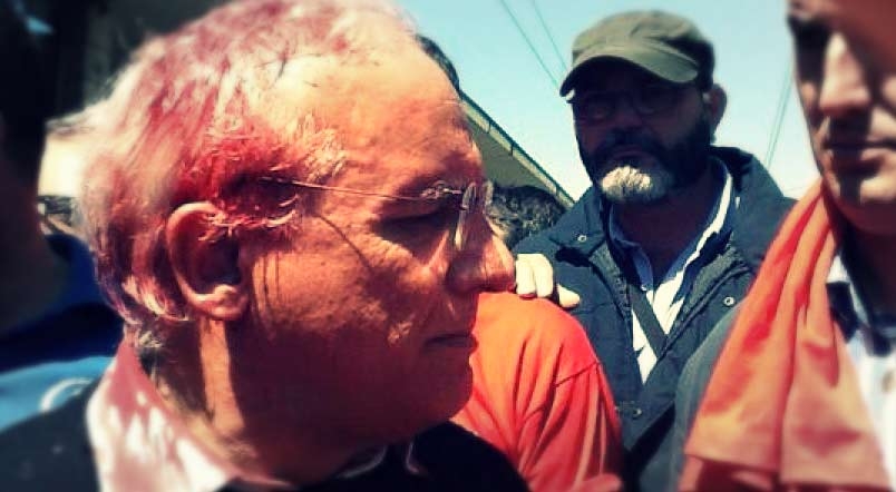 Terni. Polizia carica i lavoratori. Il sindaco ferito da una presunta ombrellata