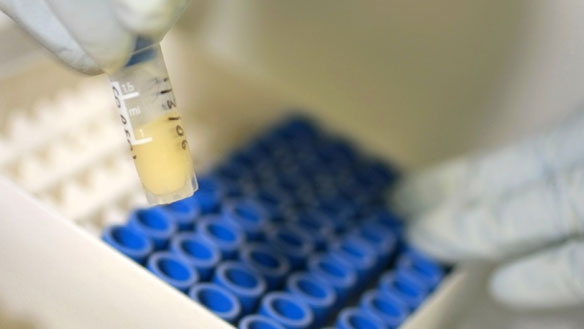 Salvate la ricerca sull’Hiv in Italia. L’appello di LIla-Nadir