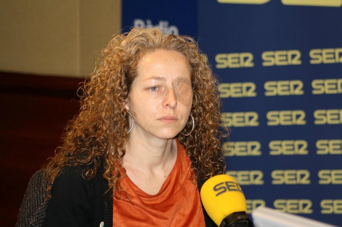 Spagna. Accecata per sbaglio durante le proteste. Ora chiede lo stop ai proiettili di gomma