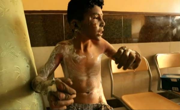 Siria. Bimbi bruciati da una bomba incendiaria. IL VIDEO CHOC