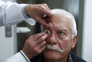 Roche e Novartis: “Ne ha di denti il pescecane”…Io intanto ho perduto la vista da un occhio
