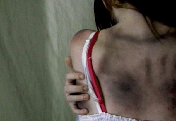 Violenza donne. Roma, picchia la compagna, si giustifica ‘Era un esorcismo’