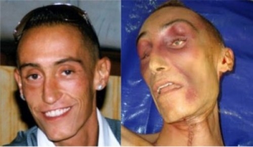 Cucchi. Il Pg, fu omicidio colposo. Chiesta la condanna per tutti gli imputati