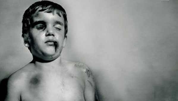 Rapporto Unicef. Violenza sui bambini in aumento