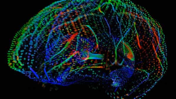 Prevenire l’autismo con una mappa 3D. VIDEO