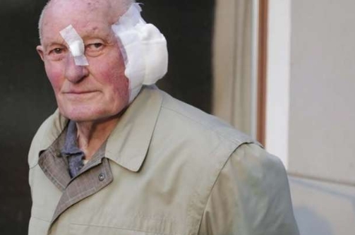 Padova. 80enne picchiato a sangue per 80 euro da ladro con accento dell’est