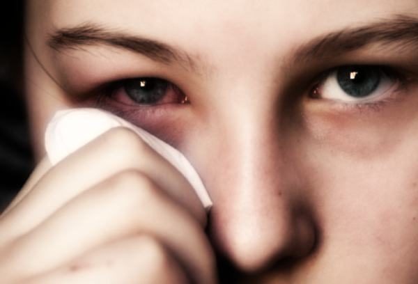Salute. Naso libera tutti, campagna contro rinite allergica