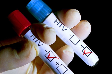 Aids. Con nuove cure evitati 7,8 milioni morti ma l’epidemia continua a crescere