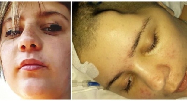Massacrò la fidanzata di botte per gelosia. Pena ridotta a 16 anni