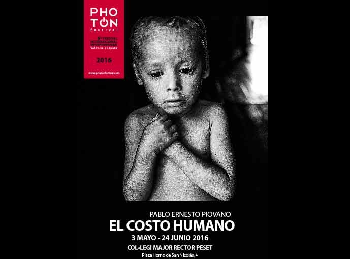 Fotografia. “El costo umanoi”. Pablo Ernesto Piovano racconta l’effetto mortale del glifosato