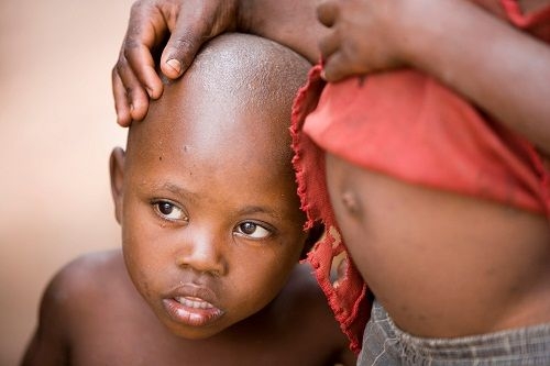 Ogni anno 3 milioni di bimbi muoiono di fame,159 milioni denutriti