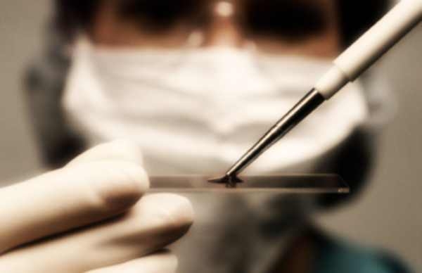 Sanità, epatite C.Garantire a tutti i pazienti l’accesso ai nuovi farmaci