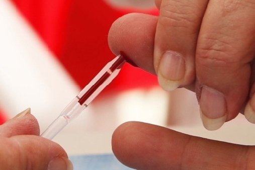 HIV, arriva nelle farmacie italiane il primo “autotest”