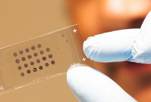 Salute, al via progetto Ue per diagnosi e terapia anticancro