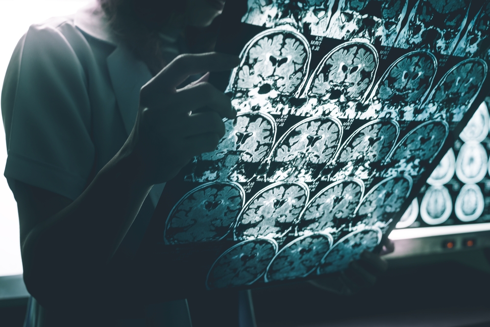 Prevenzione Alzheimer: diagnosi con occhiali e smartphone