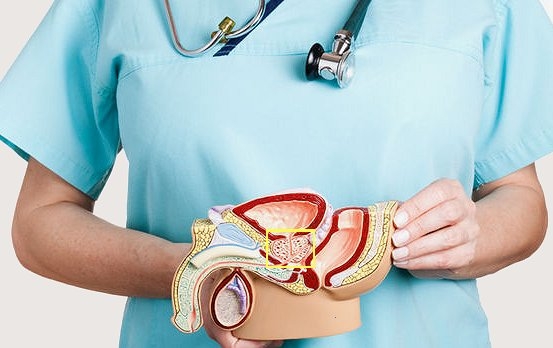 Cancro alla prostata: svelato lato oscuro della risposta immunitaria