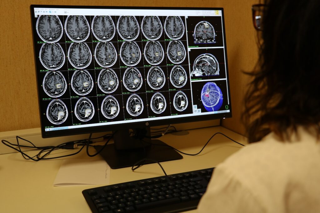Con la radiochirurgia modelli predittivi e big data per perfezionare la diagnosi