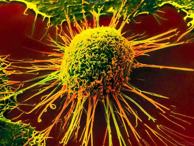 Tumore al polmone: scoperte nuove cellule immunitarie