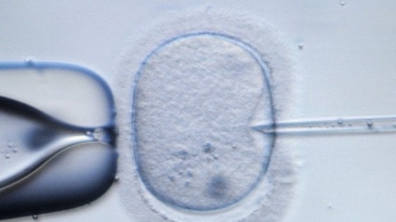 Fecondazione assistita: metodo Cnr per identificare gli ovociti più sani