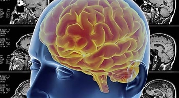 Passi avanti nella comprensione delle malattie dello sviluppo cerebrale
