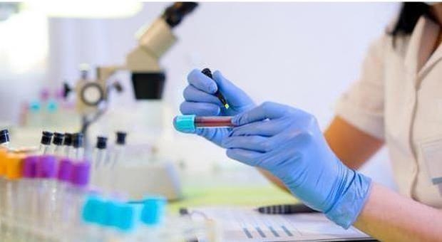 Scoperto il ruolo di un gene che regola la proteina coinvolta nello sviluppo dei tumori