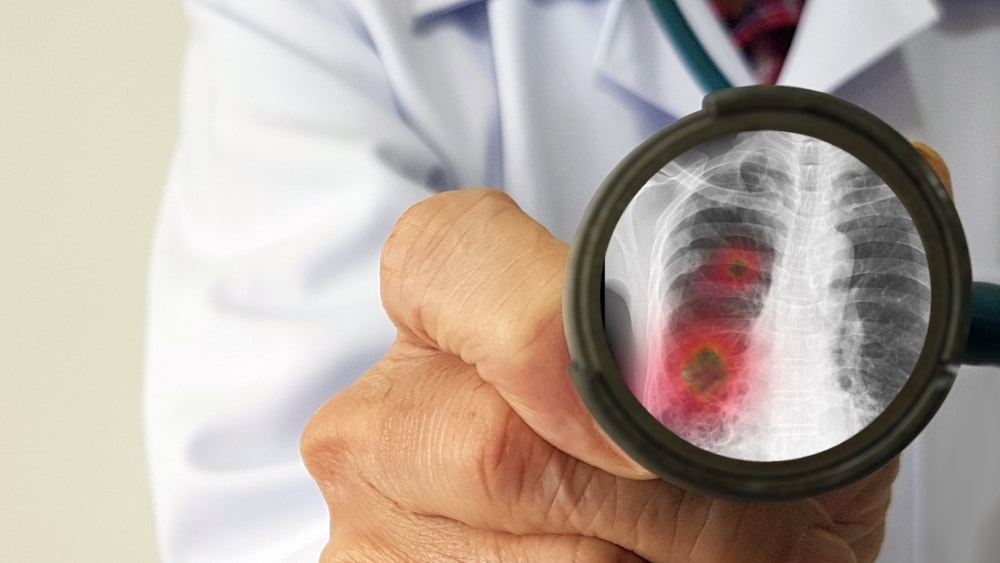 Emergenza COVID-19. “Roche si fa in quattro”