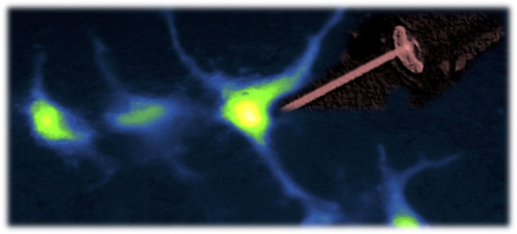 Un lampo di luce infrarossa per studiare gli astrociti e l’edema cerebrale