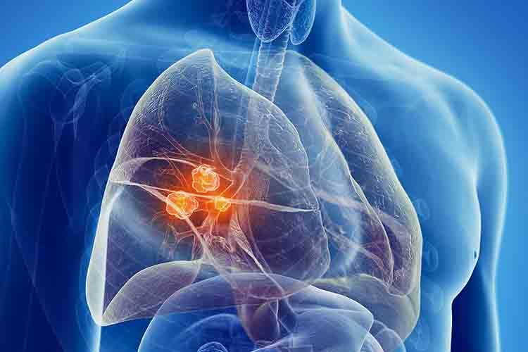 XIX Seminario di Primavera della Fondazione Ricerca Fibrosi Cistica
