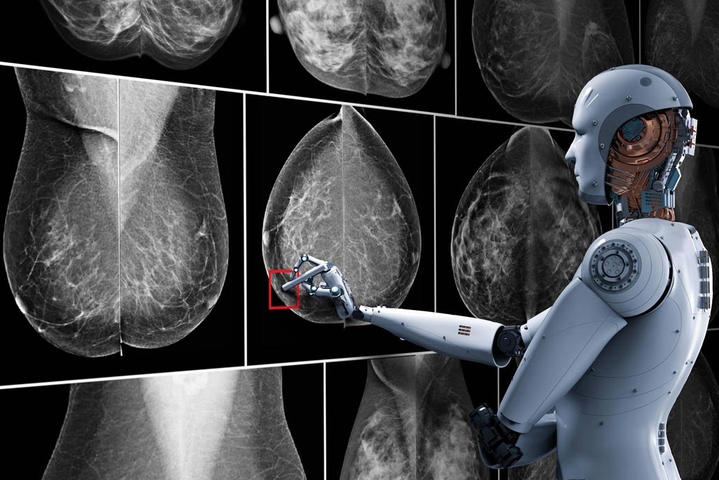 Ricerca. L’intelligenza artificiale contro il tumore al seno