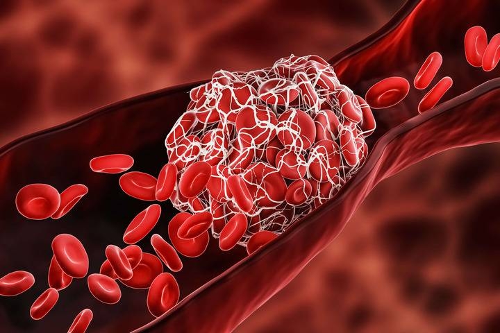 Medicina. “Corso Nazionale SISET 2021” per lo studio dell’Emostasi e della Trombosi