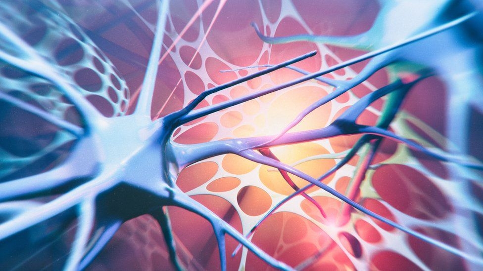 Ricerca. Università di Padova e Vimm individuano i segnali con cui il tumore altera i neuroni motori