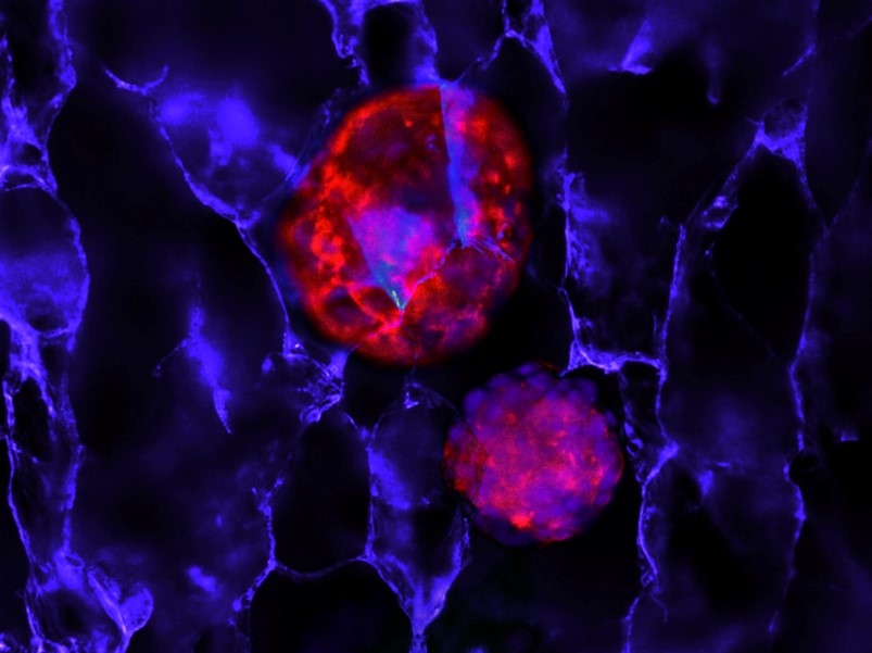 Ricerca. Un idrogel per supportare la crescita di cellule tumorali a lungo termine