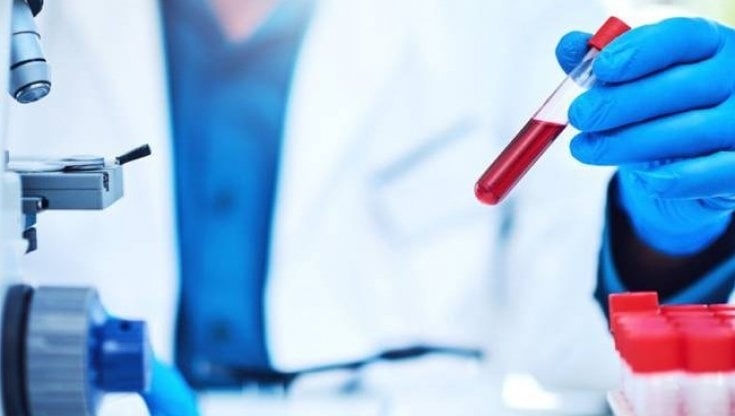 Ricerca. Identificato un nuovo potenziale target terapeutico nella Sla