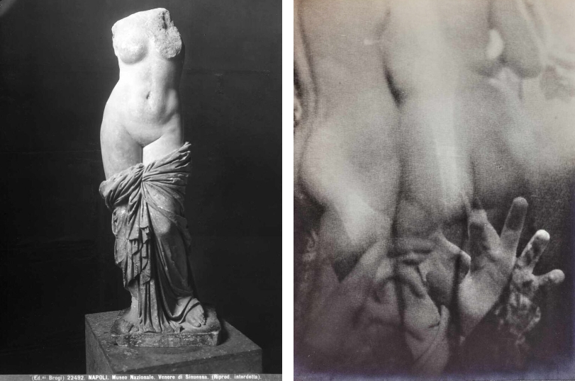 “Sexandthecancer®– Ballata Sensuale”, la sessualità oltre il cancro attraverso il linguaggio dell’arte